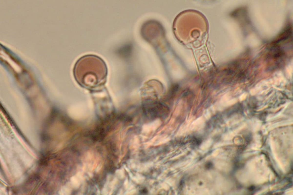Vue au microscope de poils sécréteurs d’une sauge : des têtes rondes portées par de courts pieds, à la surface de la feuille